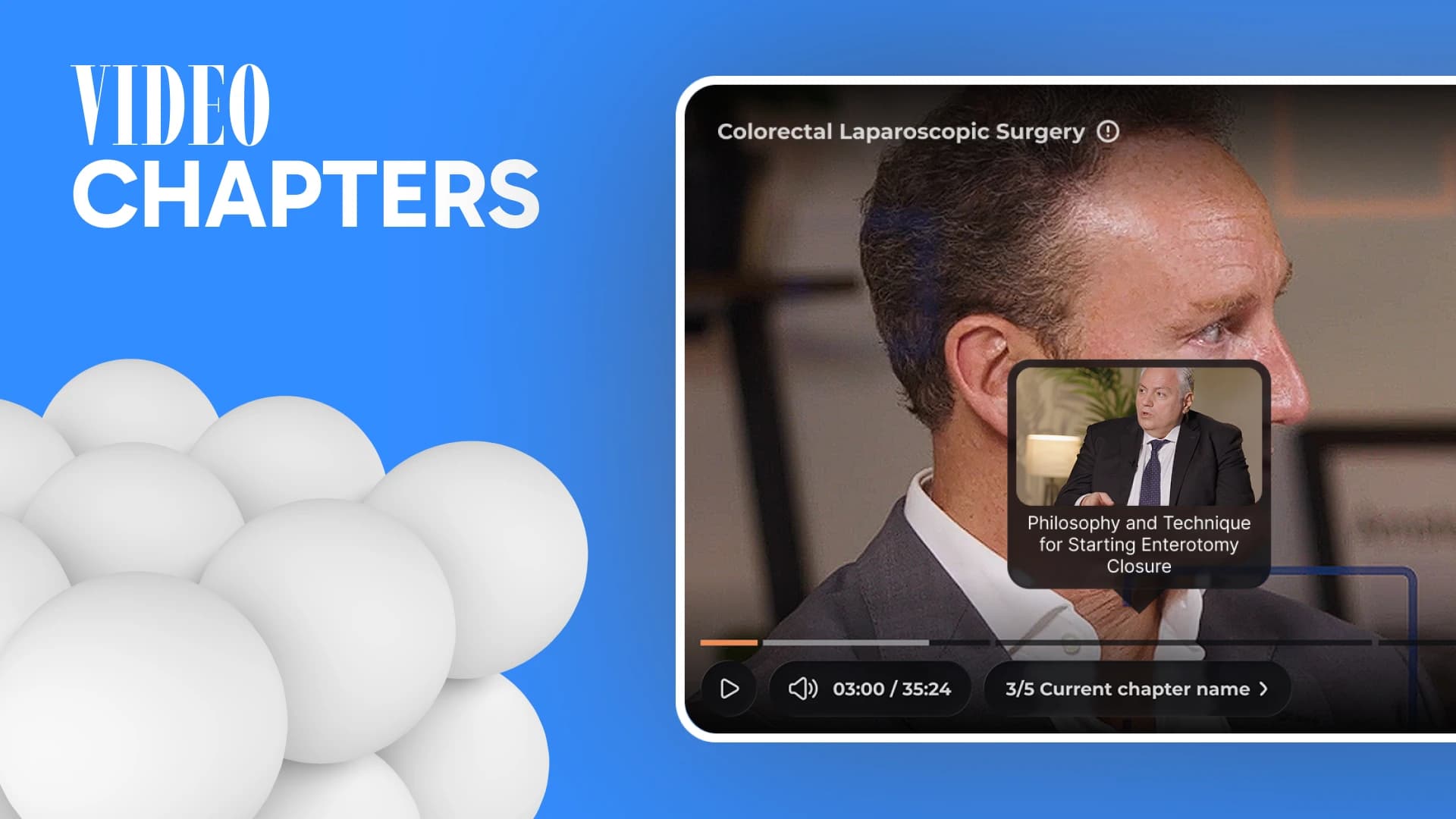 Video Chapters